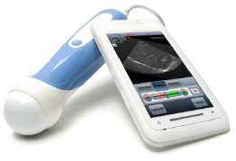 mobisante-mobile-ultrasound