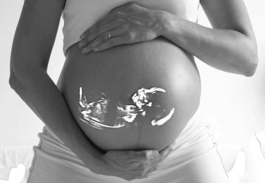 mri ultrasound pregnancy