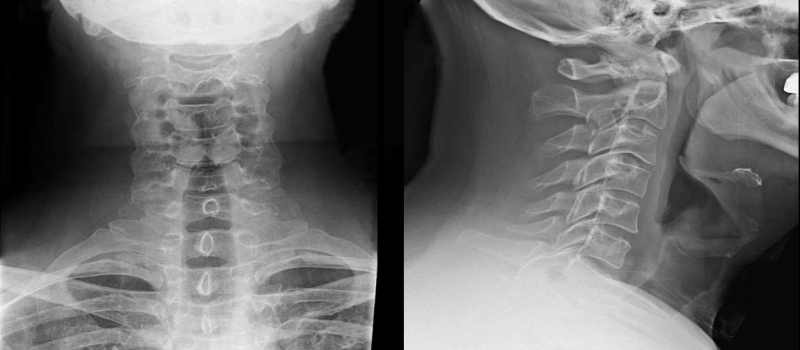 Things You Ought to Know About X-rays